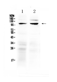 Anti-TRPC6 Antibody
