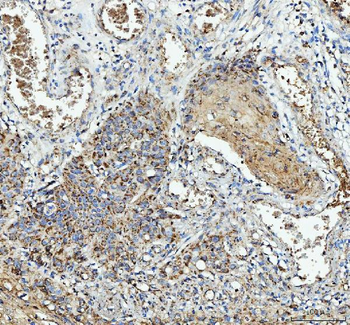 Anti-IL1RA/IL1RN Antibody