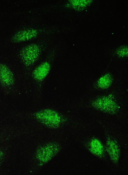Anti-PAX5 Antibody