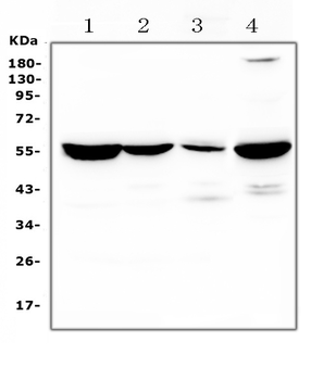 Anti-Argininosuccinate Lyase/ASL Antibody