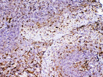 Anti-ADA Antibody