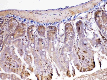 Anti-ADA Antibody