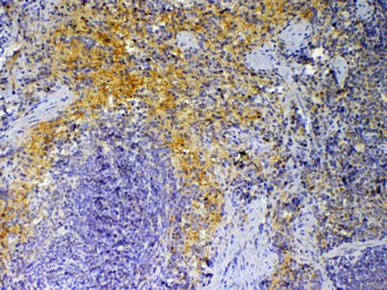 Anti-PF4 Antibody