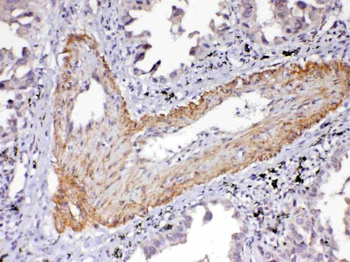 Anti-VEGF Receptor 2/KDR Antibody
