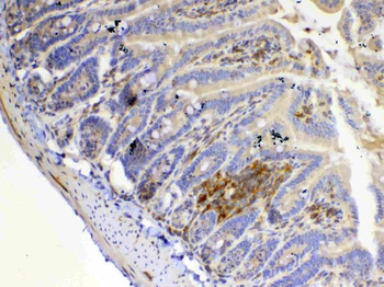 Anti-IL12A Antibody