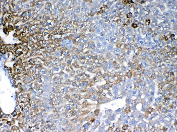 Anti-IGFBP1 Antibody