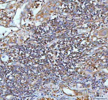 Anti-IL-22/IL22 Antibody