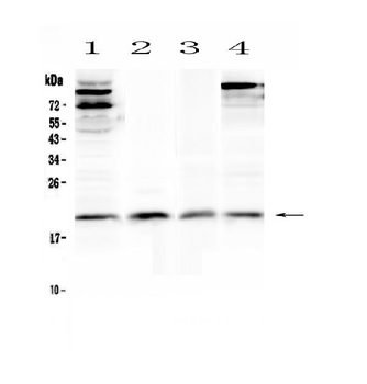 Anti-IL22 Antibody