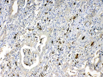 Anti-HBD Antibody