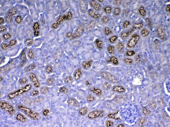 Anti-RBP4 Antibody