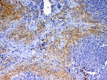 Anti-CD40L/Cd40lg Antibody
