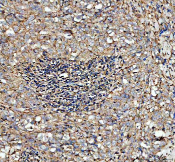 Anti-Factor D/CFD Antibody