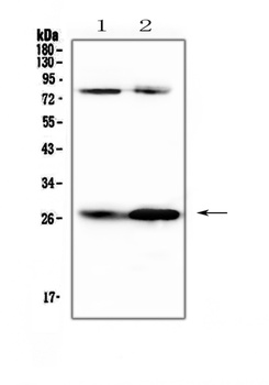 Factor D/Cfd Antibody