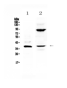 IL12B Antibody