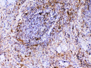 Anti-VCAM1 Antibody