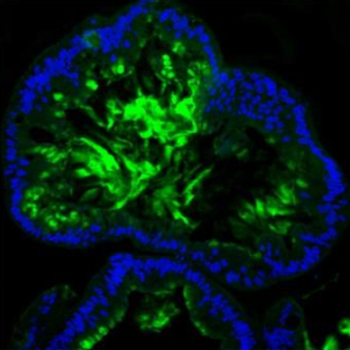 Anti-MUC2 Antibody