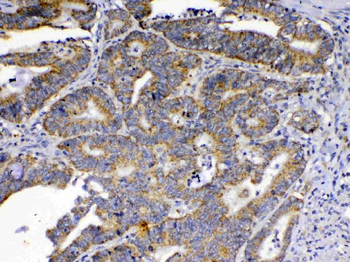 Anti-SCF/KITLG Antibody