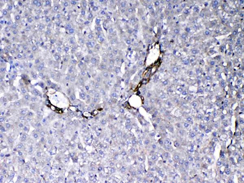 Anti-VEGF Receptor 3/FLT4 Antibody
