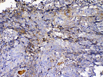 Anti-IGFBP2 Antibody
