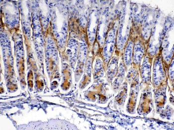 Anti-Periostin/Postn Antibody