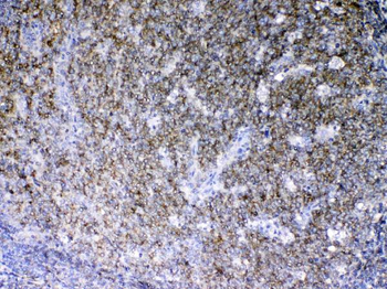 Anti-Lyn Antibody