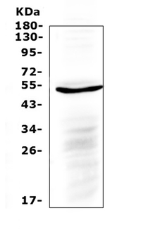 Anti-IL6R Antibody