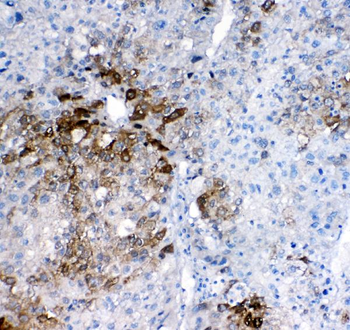 Anti-GSTA1/A2/A3/A4/A5 Antibody