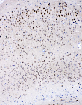 Anti-IL-16/Il16 Antibody