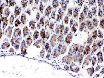 Anti-TFF3 Antibody