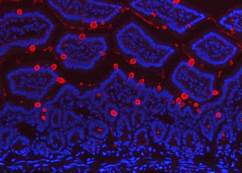 Anti-TFF3 Antibody