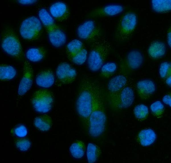 Anti-Superoxide Dismutase 3/SOD3 Antibody
