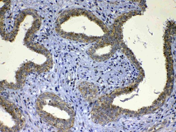 Anti-UGT1A1 Antibody
