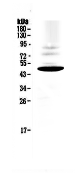 Anti-CCR1 Antibody