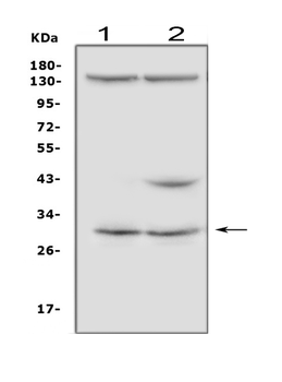 Anti-IGFBP5 Antibody