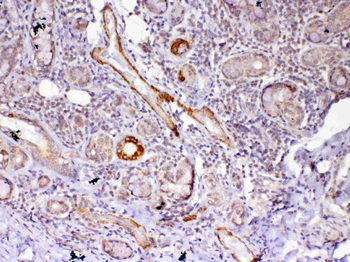 Anti-Frizzled 4/FZD4 Antibody
