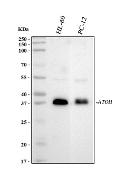 MATH1/HATH1/ATOH1 Antibody