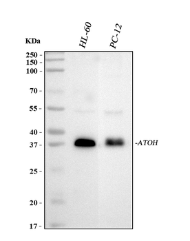 Anti-MATH1/HATH1/ATOH1 Antibody