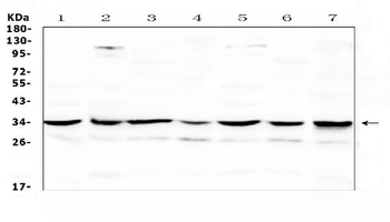 Anti-UCP2 Antibody