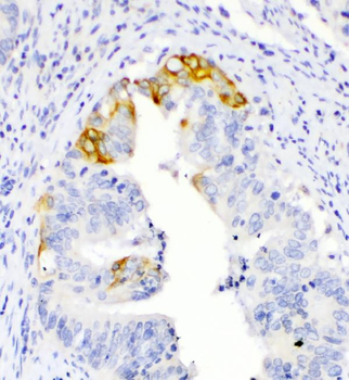Anti-TL1A/TNFSF15 Antibody