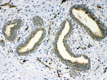 Anti-PPID Antibody