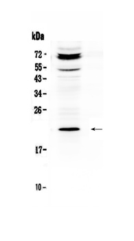 C19orf80/ANGPTL8 Antibody