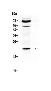 Anti-C19orf80/ANGPTL8 Antibody