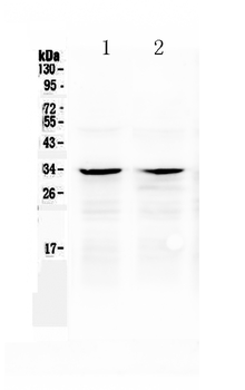 Anti-Caspase-6/CASP6 Antibody