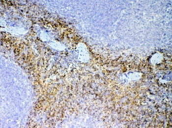 Anti-NAP2/Ppbp Antibody