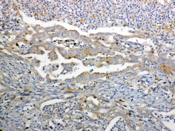 Anti-GALNS Antibody