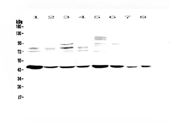Anti-PDK2 Antibody