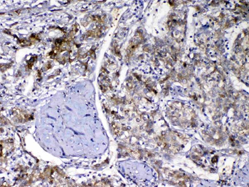 Anti-Vitamin D Binding protein/GC Antibody