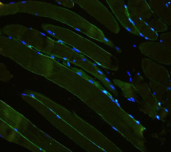 Anti-Laminin/Lamc1/Lamc2/Lamc3 Antibody
