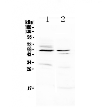 Anti-VIP Receptor 1/VIPR1 Antibody