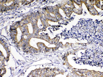 Anti-TNFSF18 Antibody